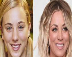 Kaley Cuoco after surgery